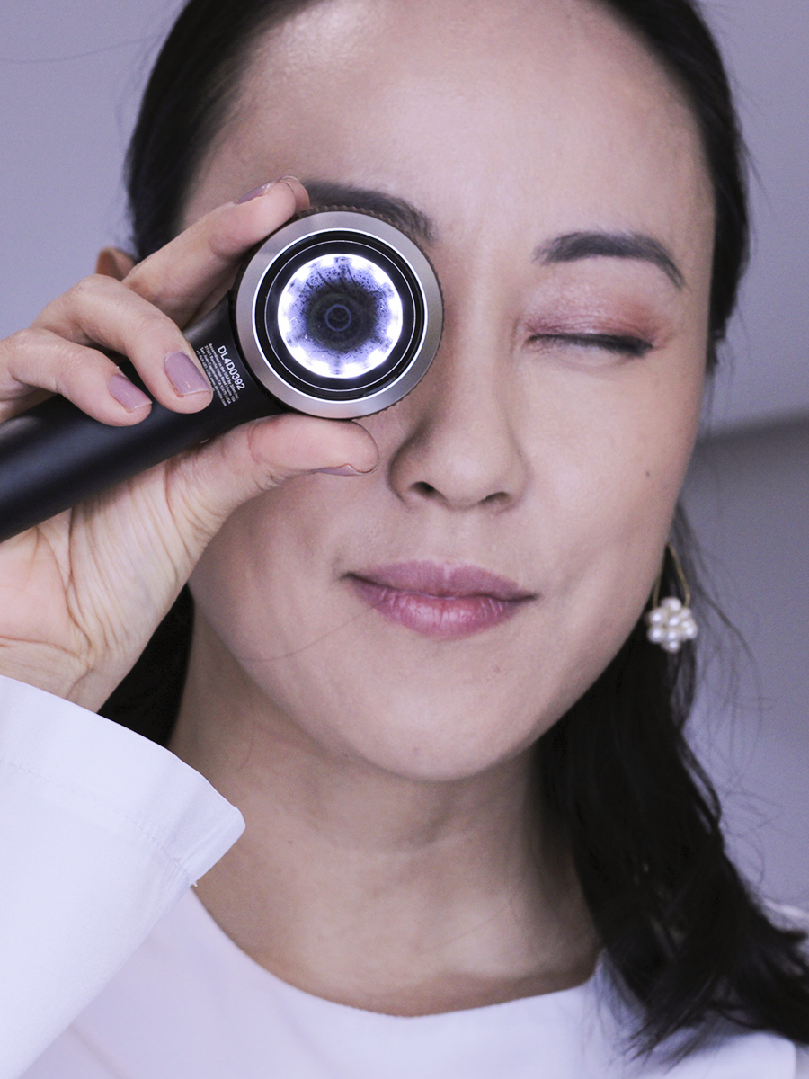 Dra. Tatiane Watanabe realizando dermatoscopia no rosto de uma paciente